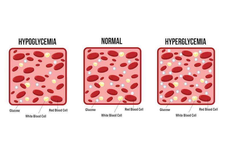 Hyperglycemia vs. Hypoglycemia: What's The Difference?