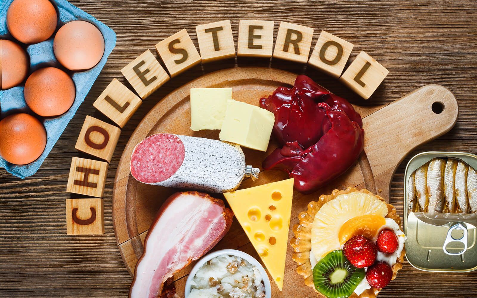 List of High-Cholesterol Foods to Avoid